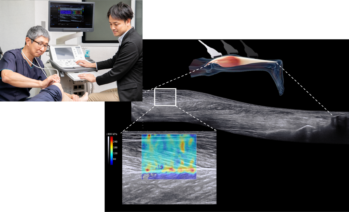 エコー検査の様子・エコー画像イメージ